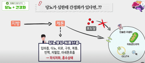 간경화와 당뇨의 합병증, 어떻게 극복할까?
