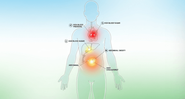 대사증후군-정의-건강검진