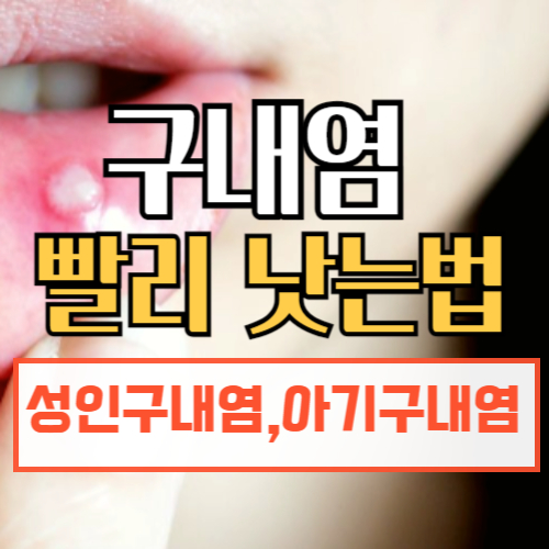 구내염 빨리 낫는법
