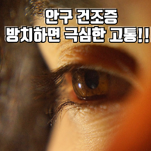 안구건조증 방치하면 안되는 이유