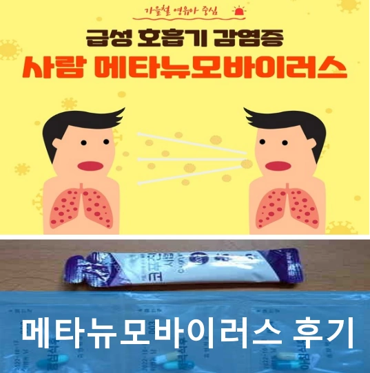 사람 메타뉴모바이러스