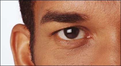 눈에 실핏줄이 터지는 이유-6