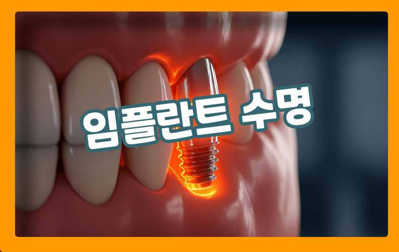 임플란트 수명 표현