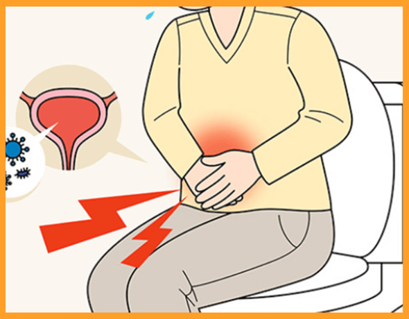 소변이-자주-마려운-증상