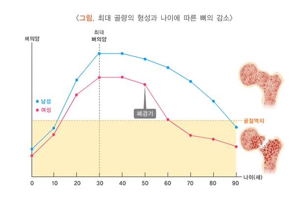 뼈 감소