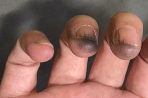 다이소헤어팡팡