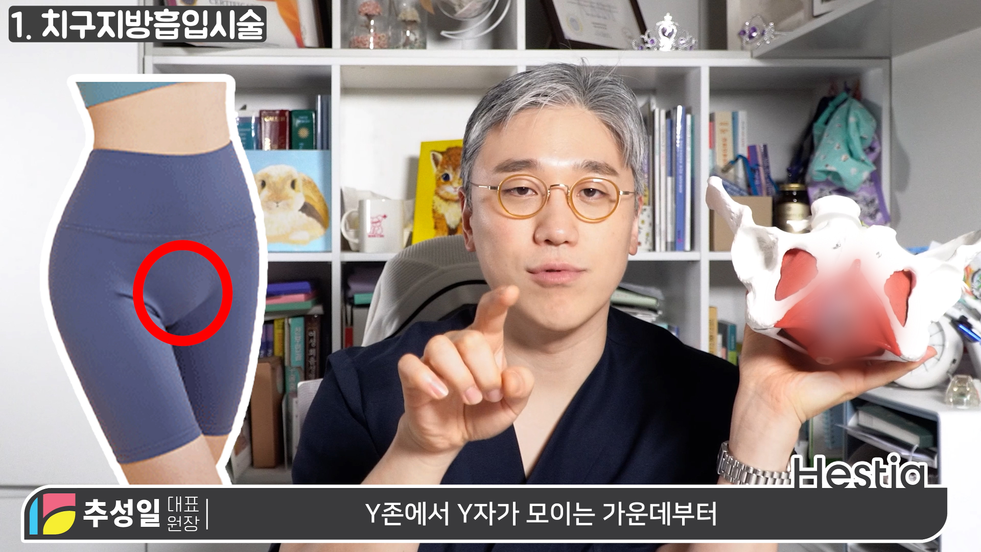 y존돌출 치구지방흡입시술