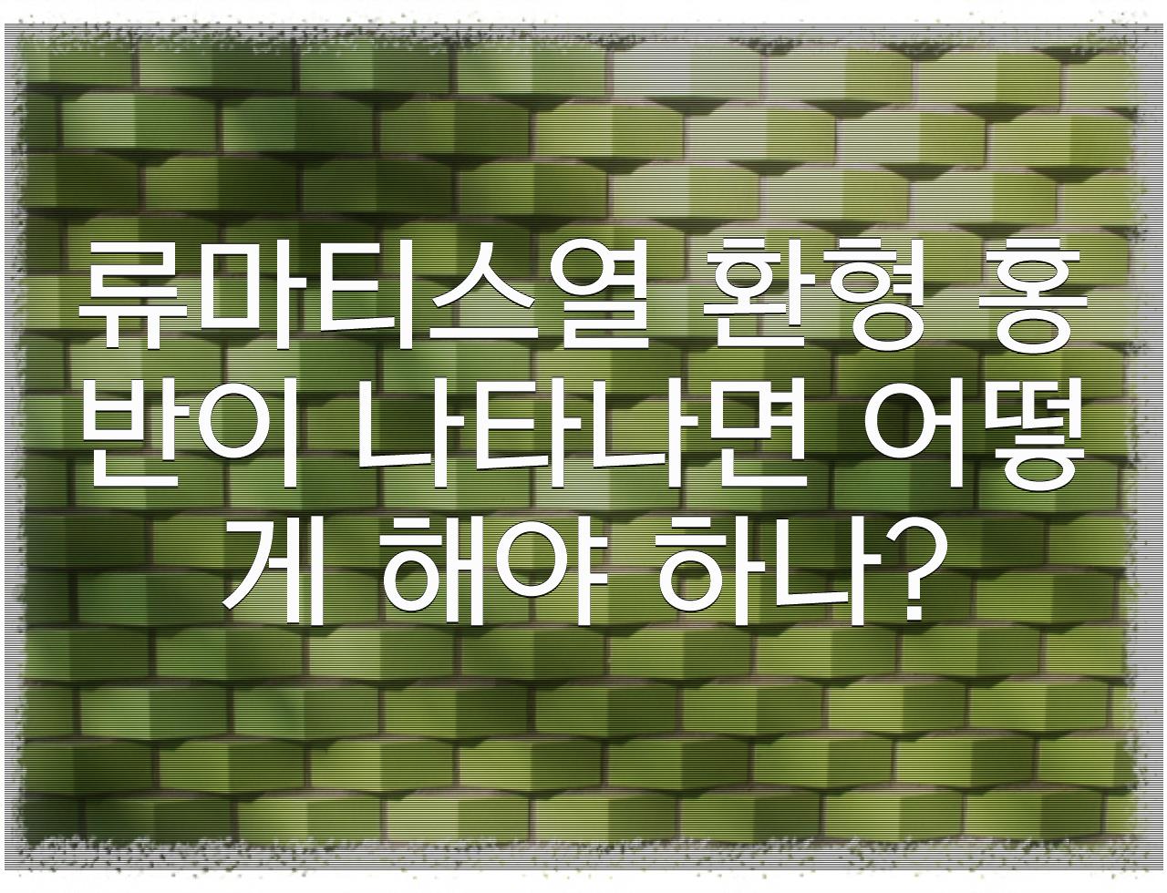 류마티스열 환형 홍반: 류마티스열의 피부 표현 - 알아보자 :: 류마티스열 환형 홍반: 류마티스열의 피부 표현 - 류마티스열 환형 홍반이 나타나면 어떻게 해야 하나? 류마티스열 환형 홍반: 류마티스열의 피부 표현 - 알아보자 :: 류마티스열 환형 홍반: 류마티스열의 피부 표현 - 류마티스열 환형 홍반이 나타나면 어떻게 해야 하나?