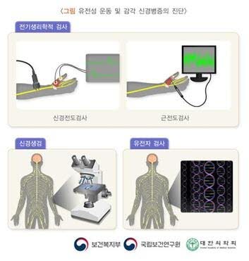 유전성 운동 및 감각 신경병증(HMSN, 샤르코-마리-투스병) 원인&middot;증상&middot;치료 총정리