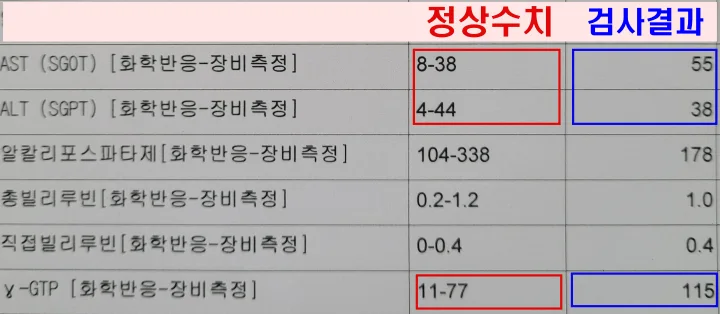 2023년-4월-간수치