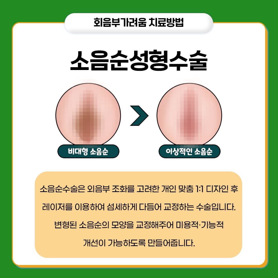 잠실산부인과 회음부가려움 치료방법: 소음순성형수술
