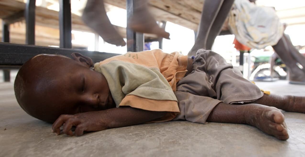 가뭄으로 지쳐 쓰러진 아이