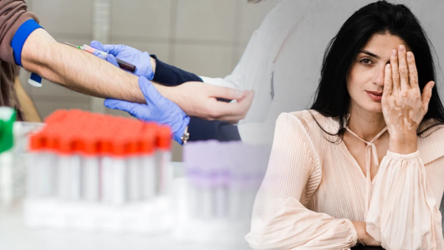 백반증 완벽 가이드