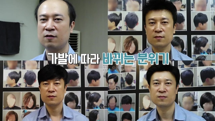 이건뭐고 탈모 성지 모발이식 헤어라인 교정 전문 병원, 맞춤 가발, 부분가발, 항암가발, 정수리가발 추천