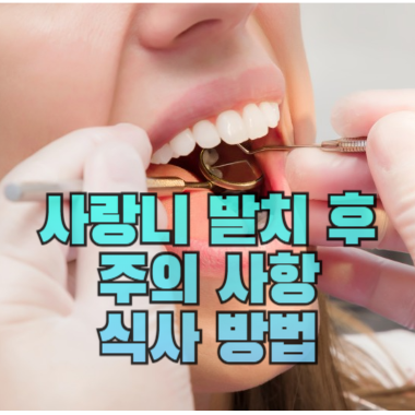 사랑니 발치 후, 주의사항, 식사방법