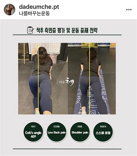 척추측만증 교정운동