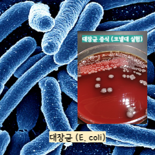식중독-증상