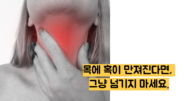 갑상선암 초기증상