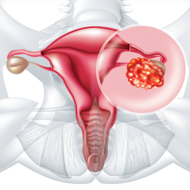 여성 난소 그림