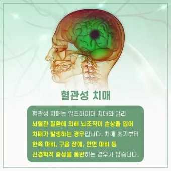 혈관성치매 원인 증상 치료법과 예방 생활습관_13