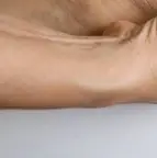 손발 저림 원인