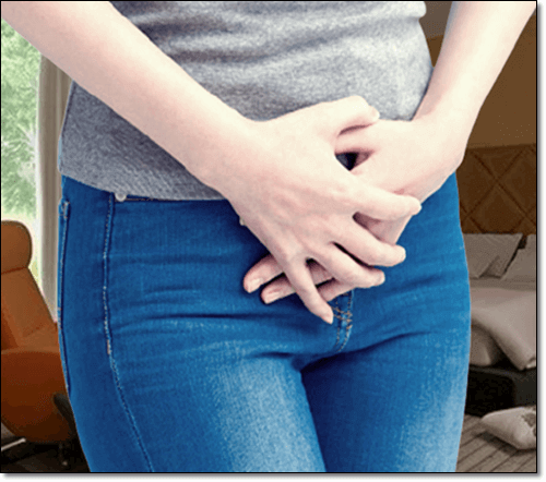 다낭성 난소증후군 여성