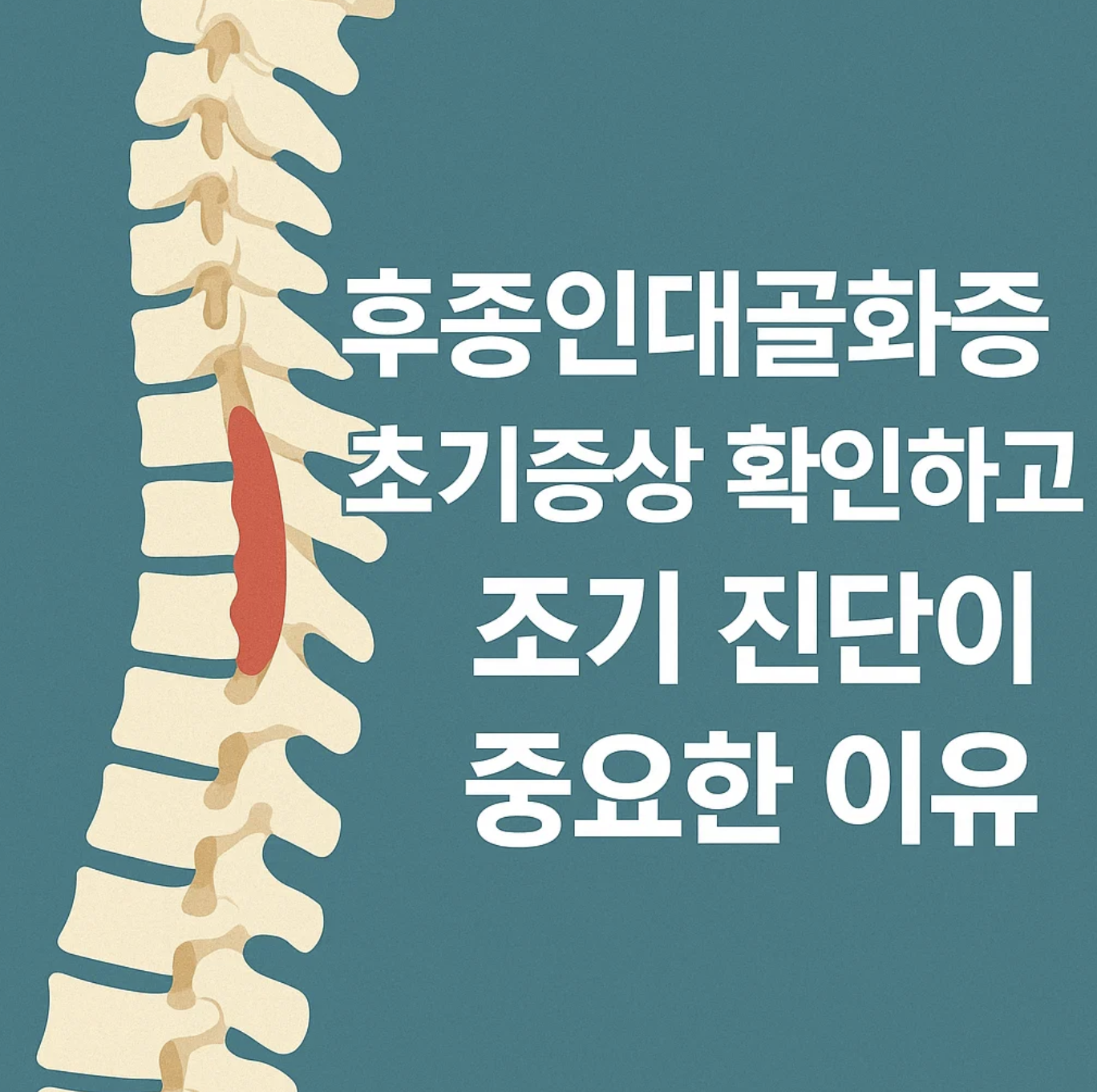 후종인대골화증 초기증상 확인하고 조기 진단이 중요한 이유