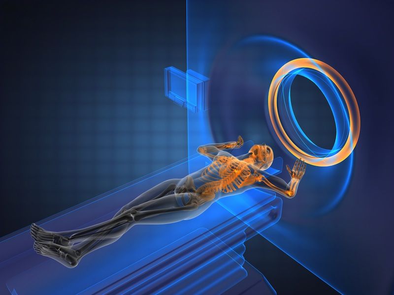 MRI
