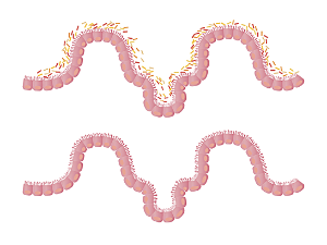 대장내시경비용,검사시간-이미지