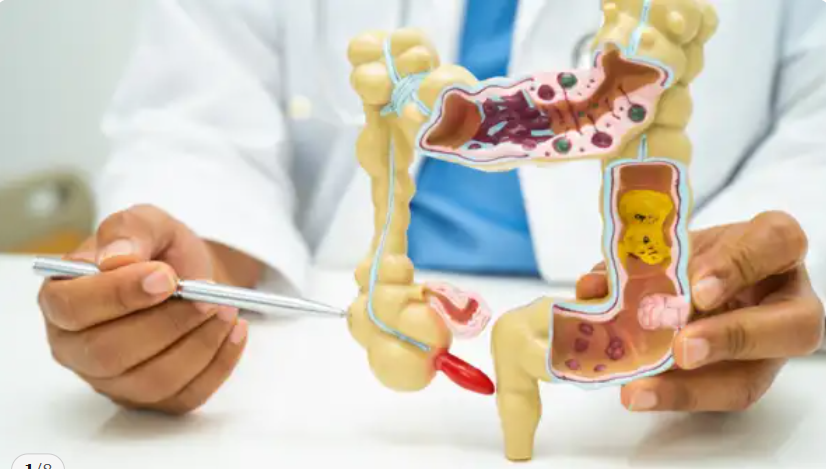 충수암 관련 사진