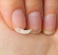 손톱이 잘 부러지는 이유