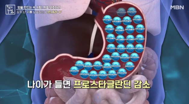 그린세라-f-효능-부작용-위암-예방