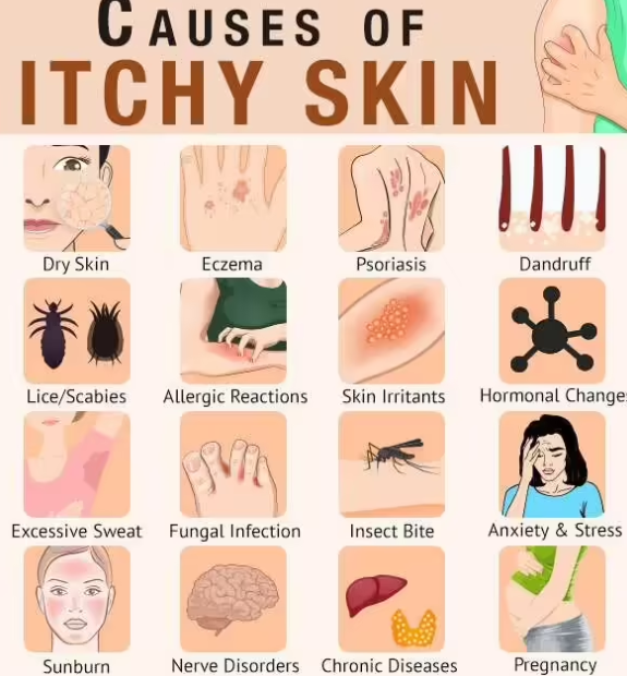 피부가려움증의 원인 1