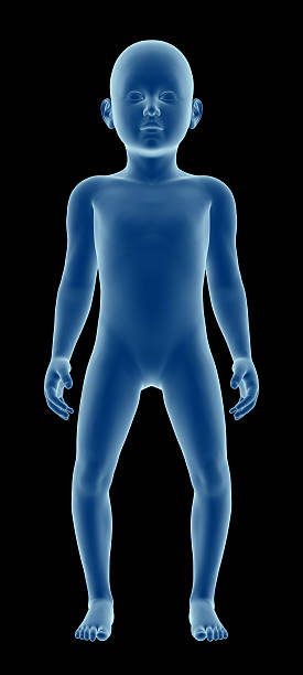 오다리 교정 깔창 오징어 운동 수술 교정기 원인 무릎 내반슬 외반슬 각도 보조기 O다리