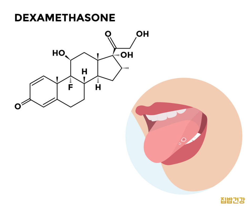 덱사메타손 효과