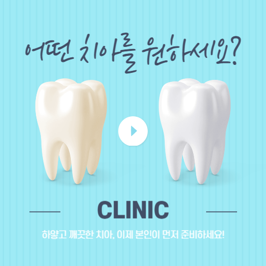 임플란트 가격비교 사이트