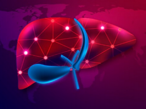 간수치가 높아지는 원인