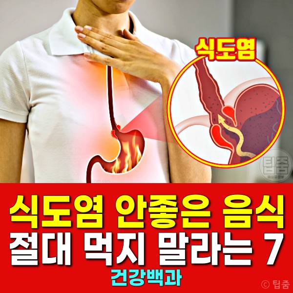 식도염 안좋은 음식 식도염 치료 기간