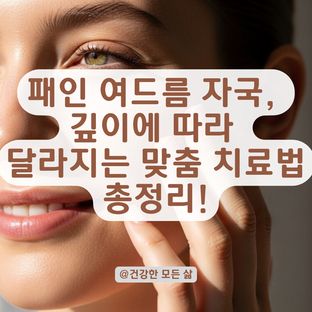 흉터 깊이에 따라 달라진다, 패인 여드름 자국에 쓰이는 치료 방법 비교.
