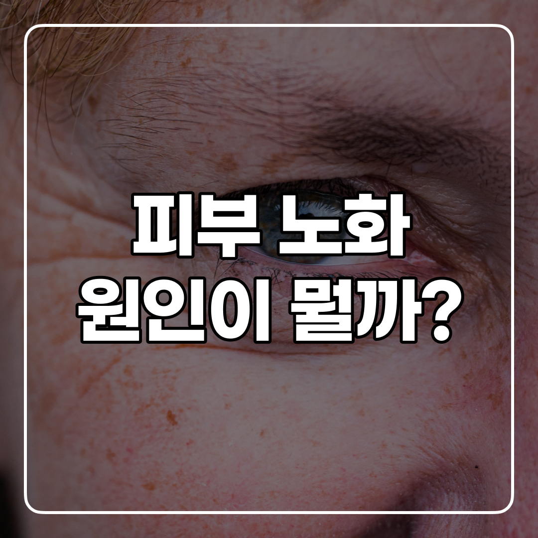 피부 노화 원인