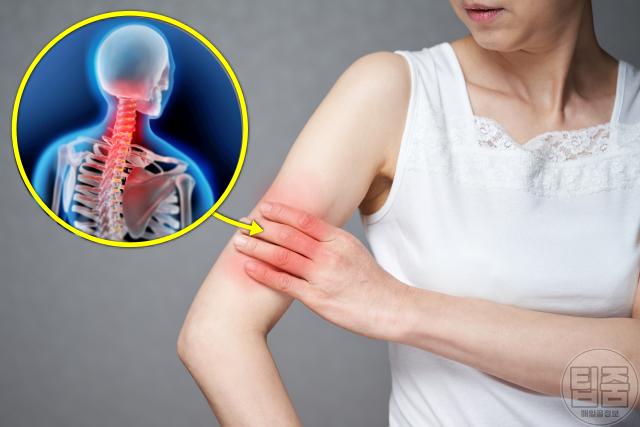 추간판탈출증 증상 팔다리통증 디스크탈출증