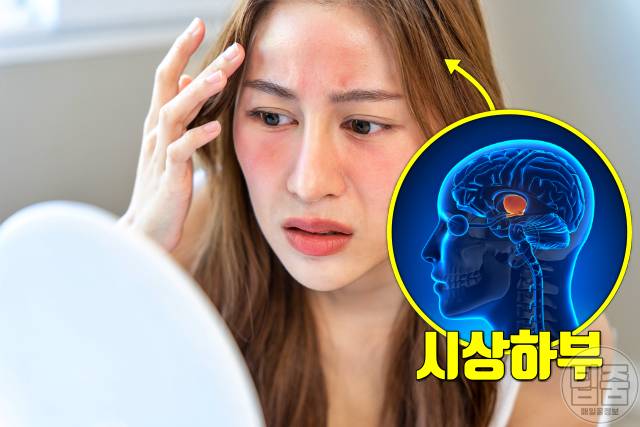 땀 많이 나는 병 다한증 원인 폐경 갱년기