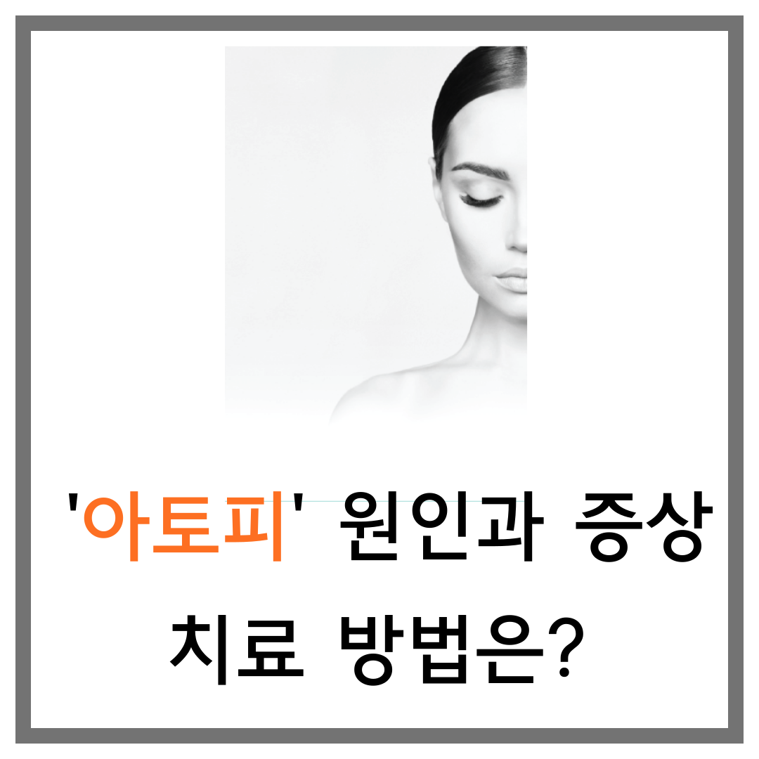 아토피피부염 원인&#44; 증상