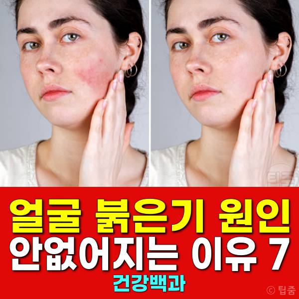 얼굴 붉은기 원인 얼굴 빨개지는 이유 얼굴홍조 원인