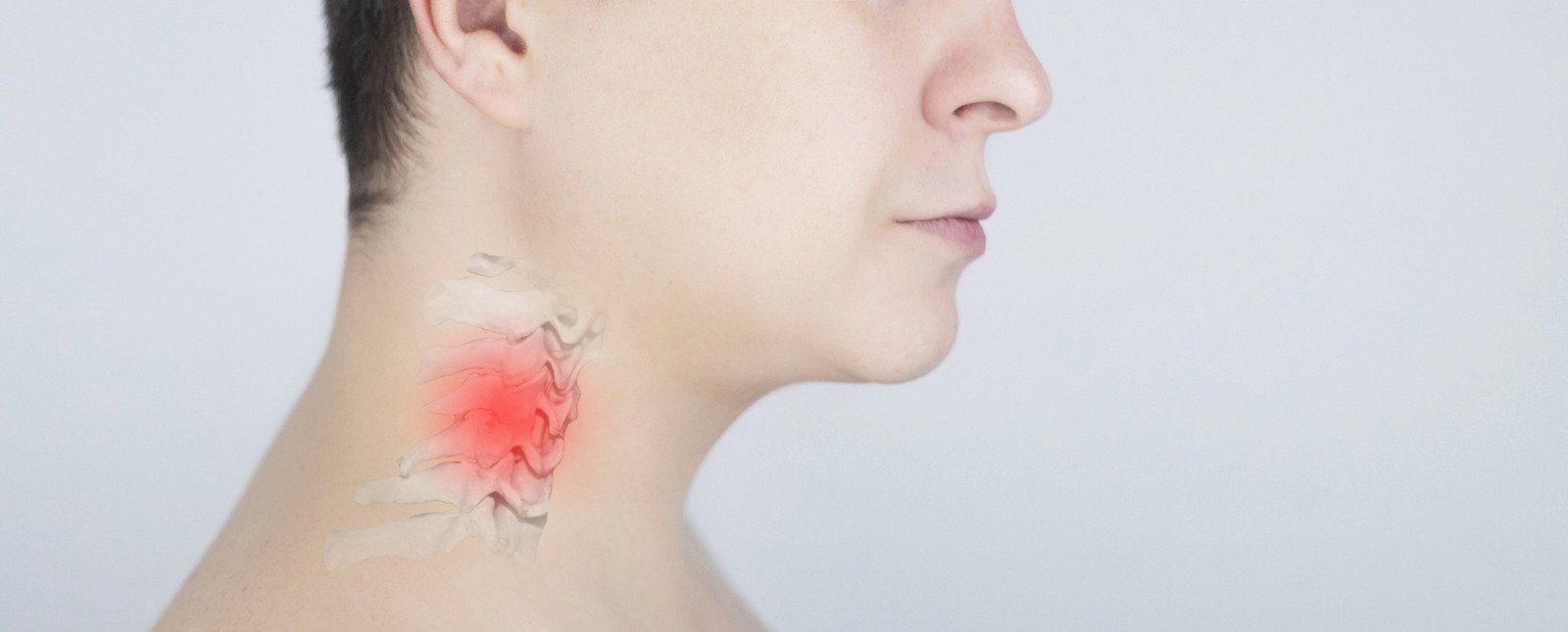 경추 디스크 (Cervical Herniated Disc): 원인, 증상, 치료법 총정리