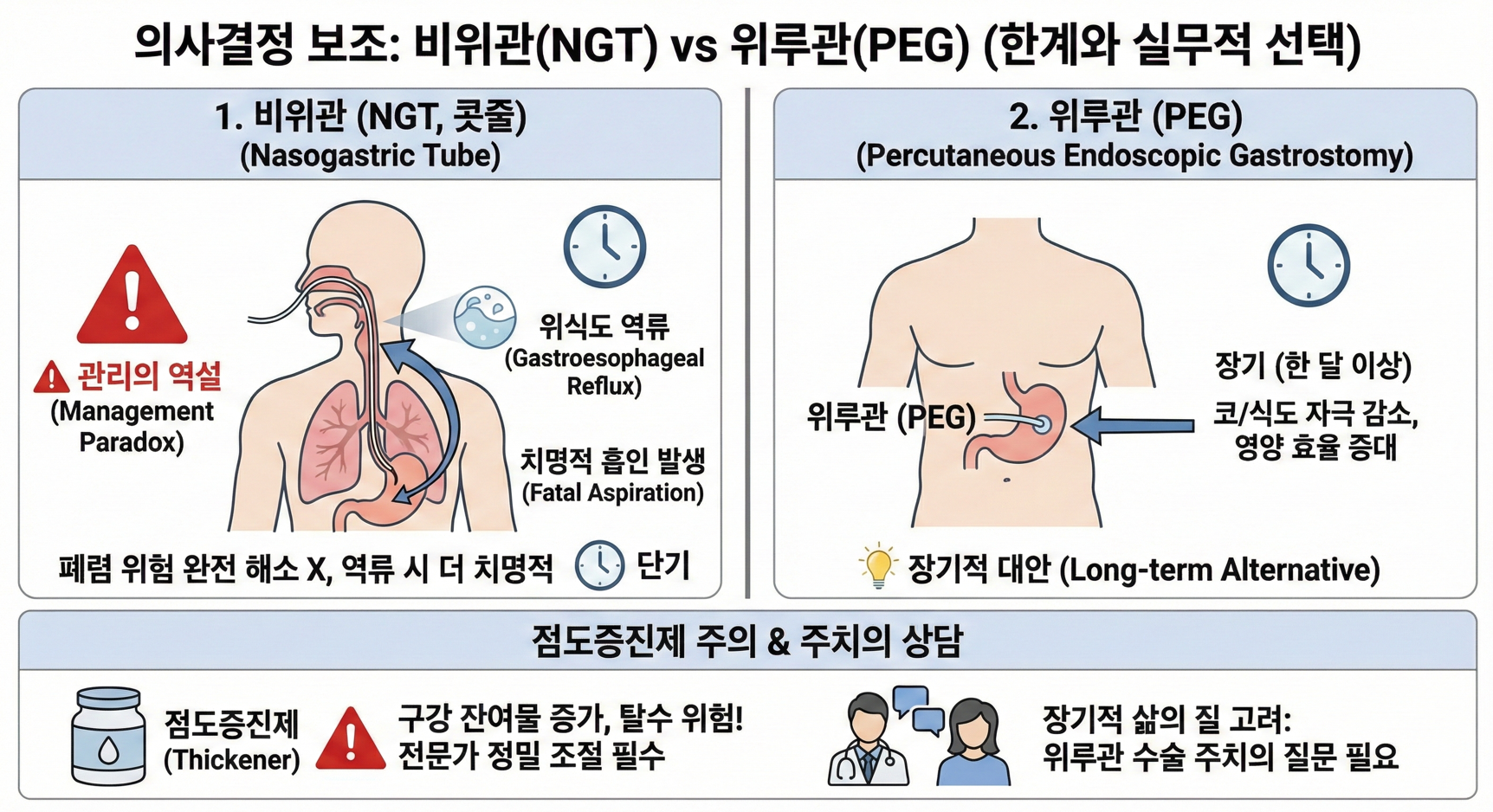 의사결정 보조를 위한 콧줄(NGT)과 위루관(PEG) 비교. 비위관의 역류 및 관리의 역설 위험, 장기 영양 공급 대안으로서의 위루관 특징, 점도증진제 사용 시 주의사항