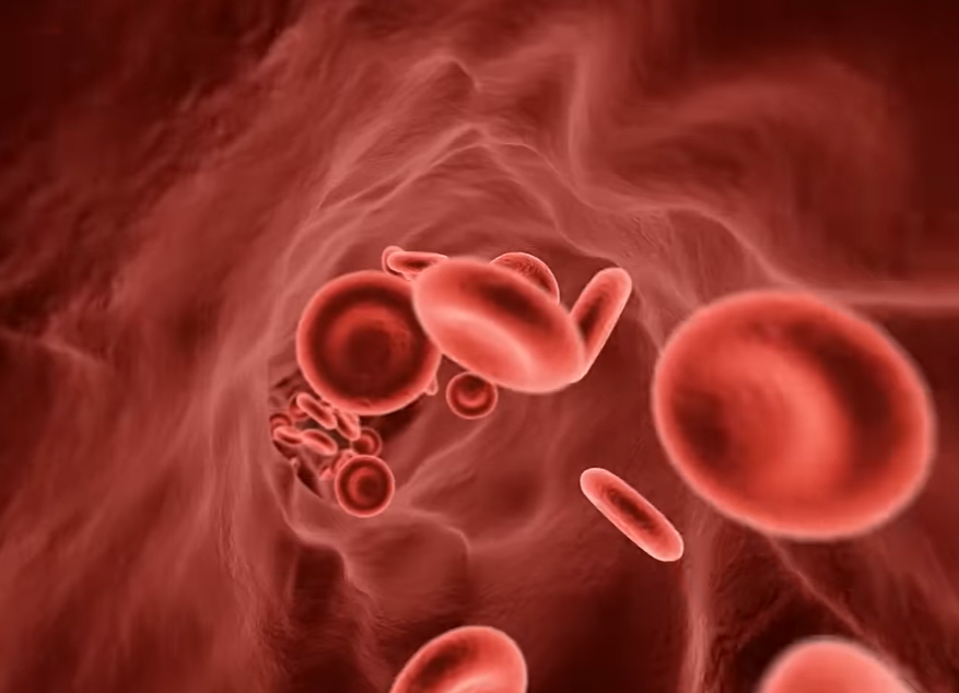 지방간 없애는 방법