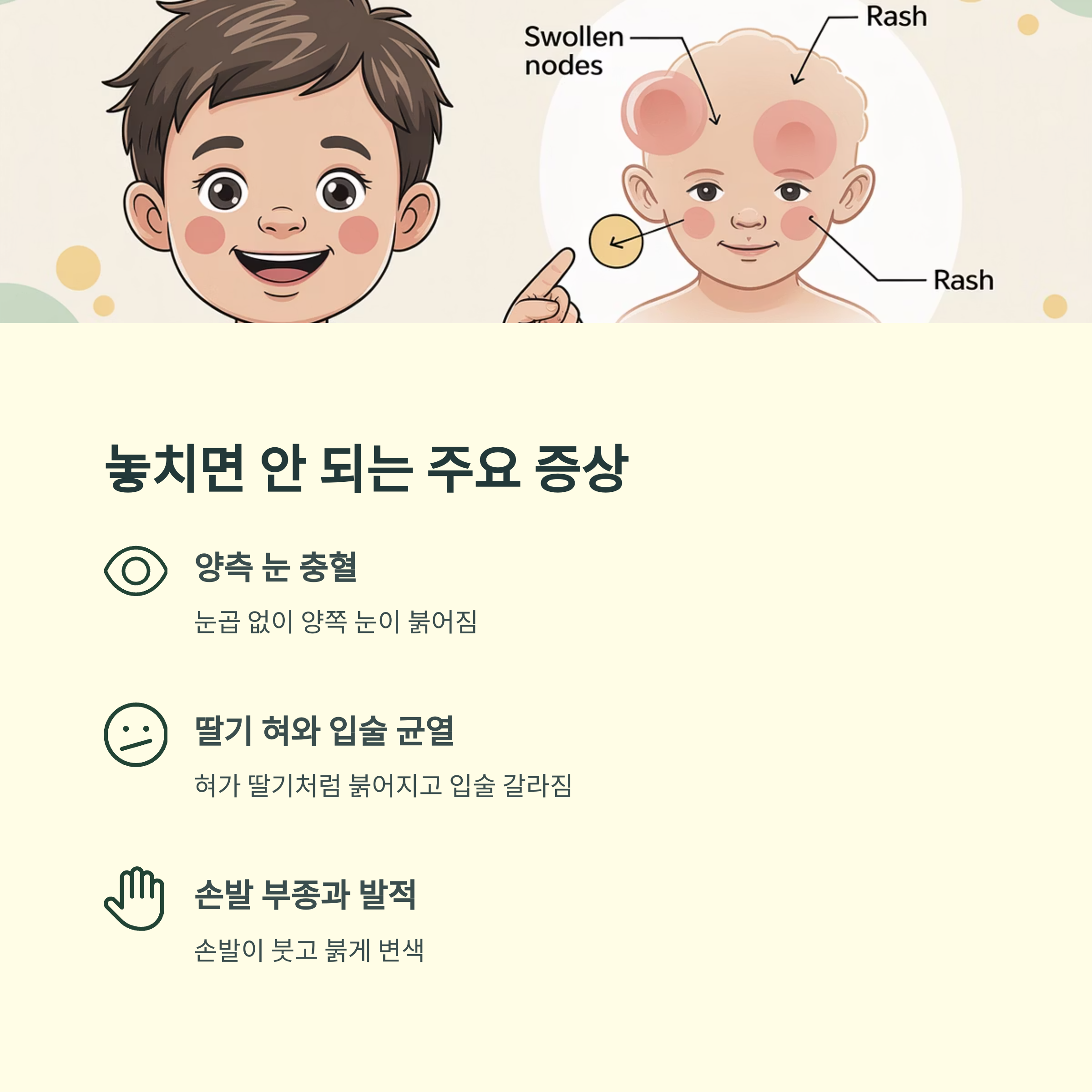 아기 얼굴에 붉은 발진과 림프절 부종을 강조하며 양측 결막충혈, 딸기 혀, 손발 발적 등 주요 증상을 설명한 이미지