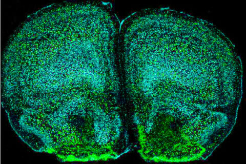 뇌와 면역 시스템의 상호작용