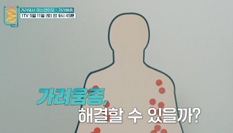 가려움증해결가능할까